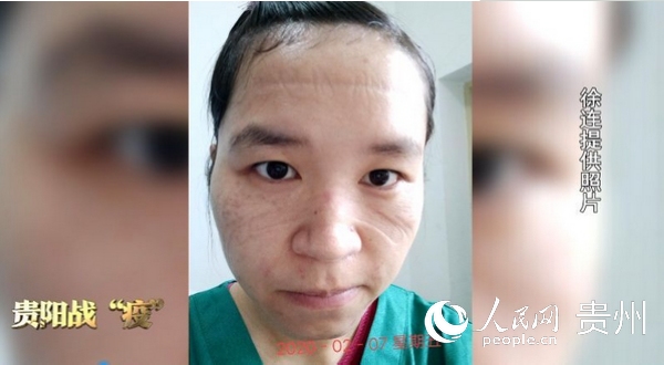 ���Bժ�¿��ֺ����µĺ��E׌�����ۡ�