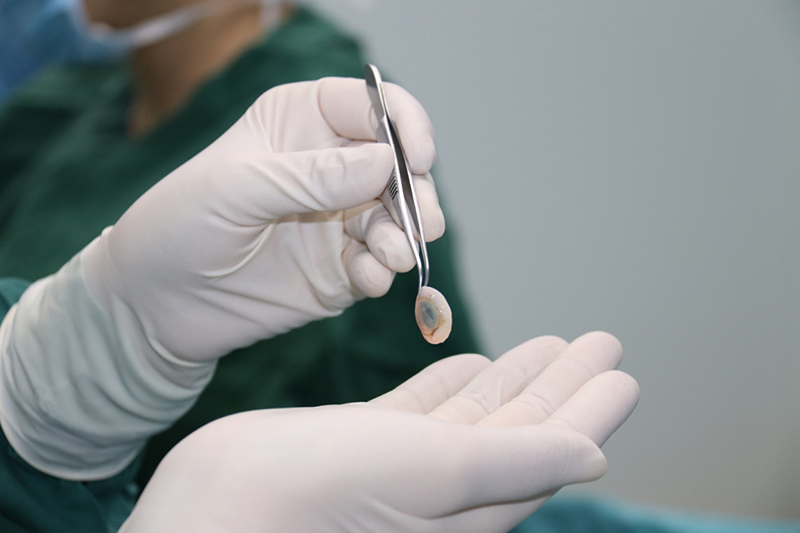 醫生正在為患者做手術。